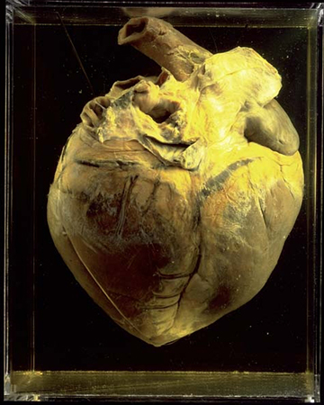 Phar Lap’s heart displayed at the National Museum of Australia